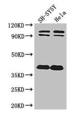Western Blot. Positive WB detected in: SH-SY5Y whole cell lysate, Hela whole cell lysate. All lanes: DISC1 antibody at 2ug/ml. Secondary. Goat polyclonal to rabbit IgG at 1/50000 dilution. Predicted band size: 94, 92, 74, 39, 83, 63, 61, 76, 73, 38, 22 kDa. Observed band size: 94, 92, 38 kDa