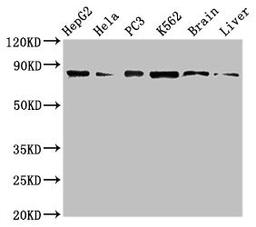 Western Blot. Positive WB detected in: HepG2 whole cell lysate, Hela whole cell lysate, PC-3 whole cell lysate, K562 whole cell lyaste, Mouse brain tissue, Rat liver tissue. All lanes: STAT4 antibody at 1µg/ml. Secondary. Goat polyclonal to rabbit IgG at 1/50000 dilution. Predicted band size: 86 kDa. Observed band size: 86 kDa