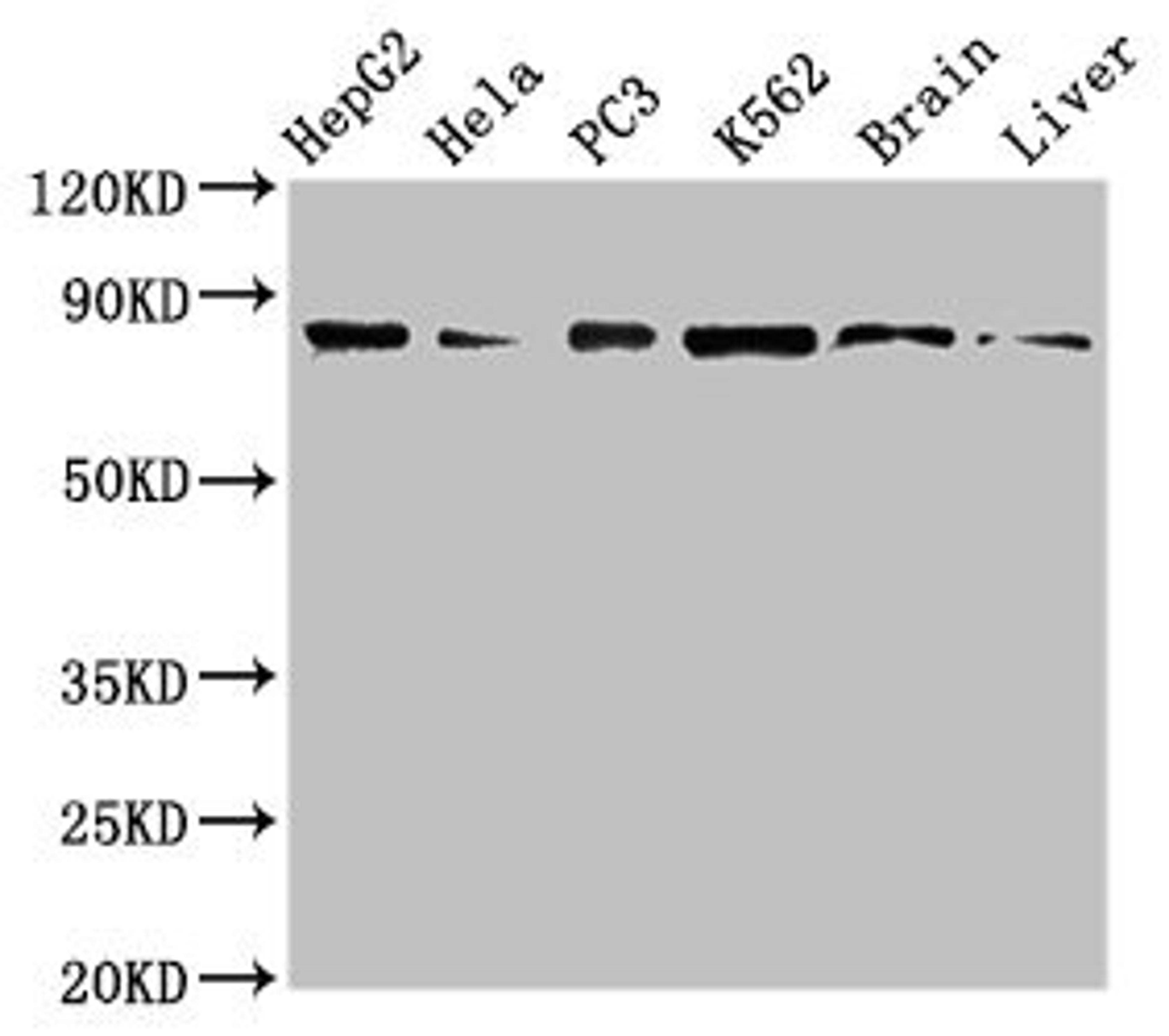 Western Blot. Positive WB detected in: HepG2 whole cell lysate, Hela whole cell lysate, PC-3 whole cell lysate, K562 whole cell lyaste, Mouse brain tissue, Rat liver tissue. All lanes: STAT4 antibody at 1µg/ml. Secondary. Goat polyclonal to rabbit IgG at 1/50000 dilution. Predicted band size: 86 kDa. Observed band size: 86 kDa