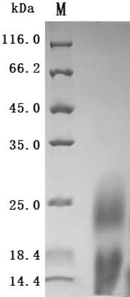 (Tris-Glycine gel) Discontinuous SDS-PAGE (reduced) with 5% enrichment gel and 15% separation gel.