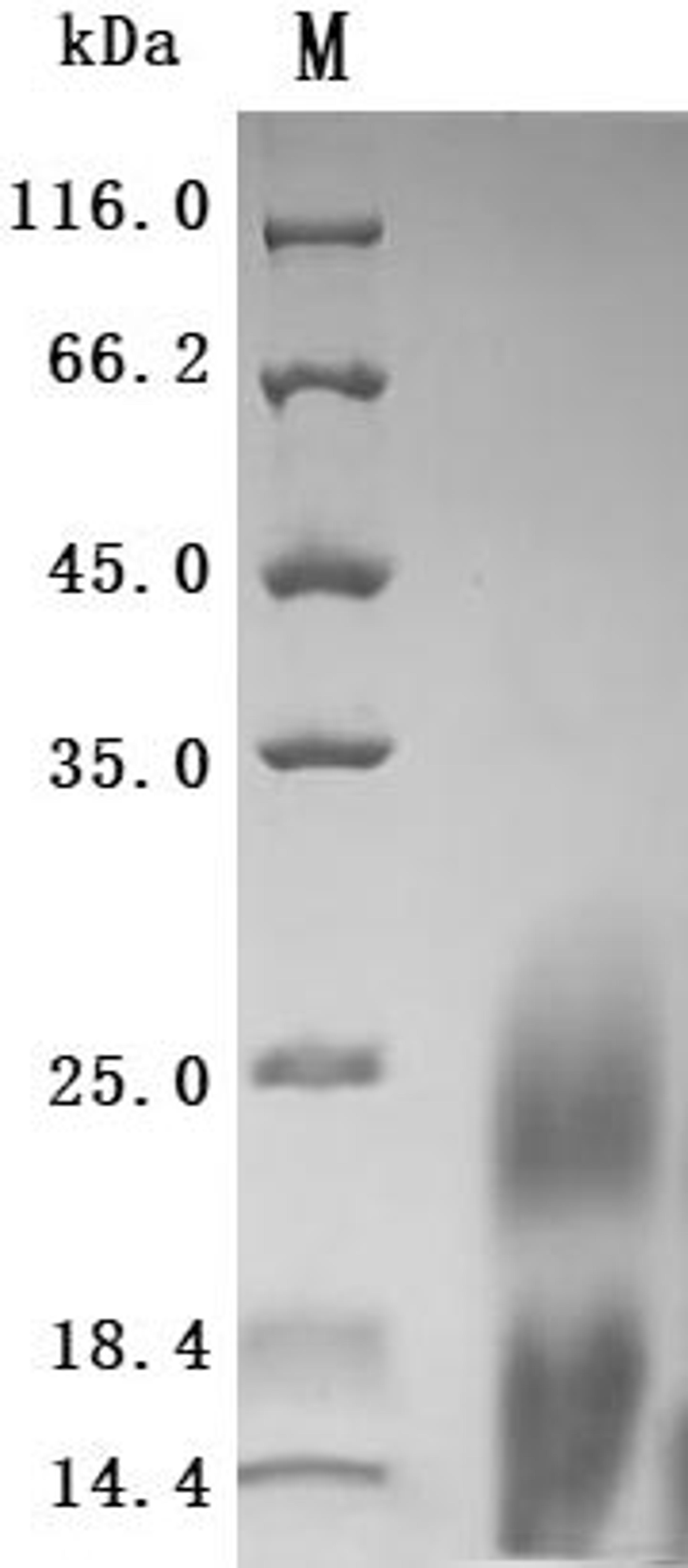 (Tris-Glycine gel) Discontinuous SDS-PAGE (reduced) with 5% enrichment gel and 15% separation gel.