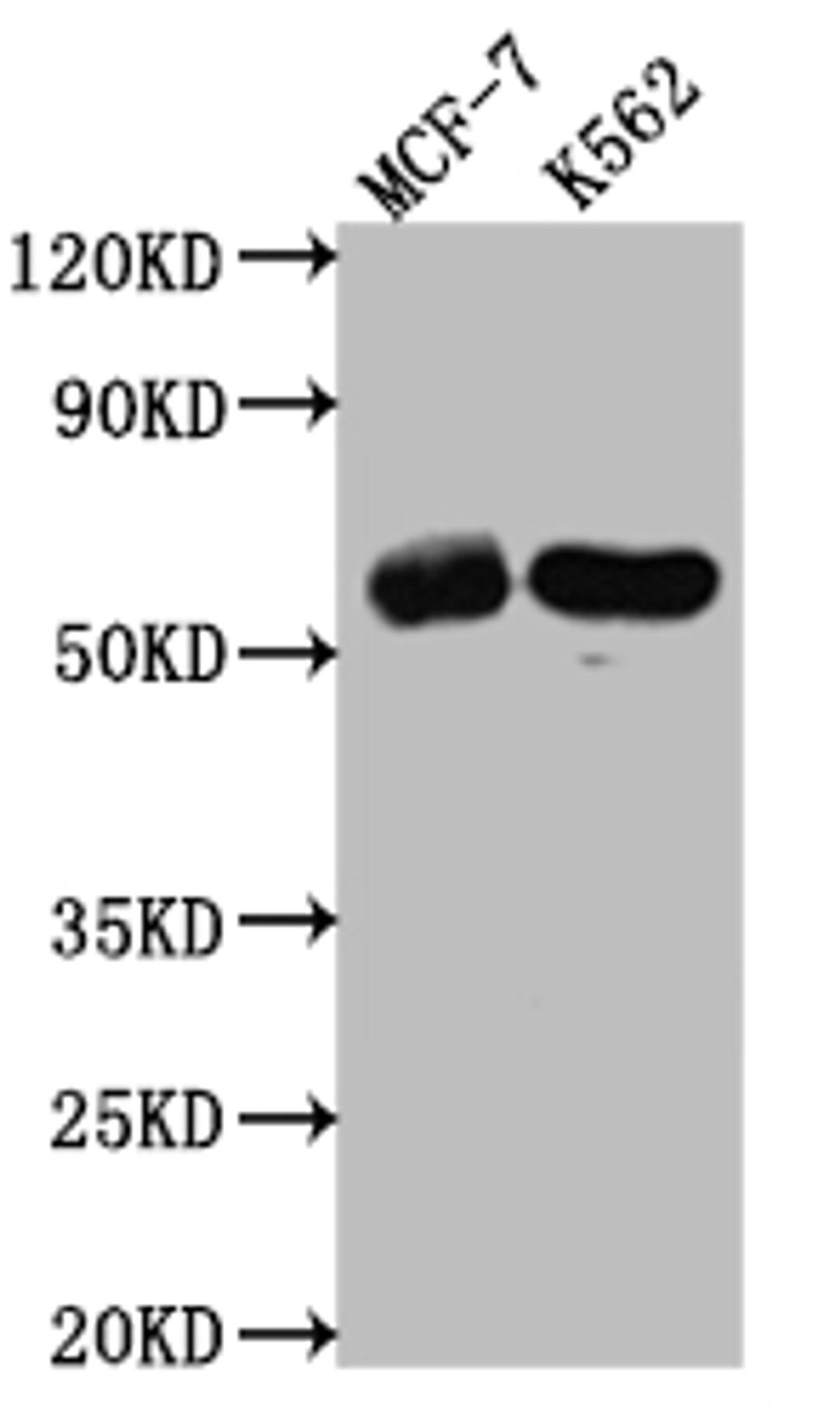 Western Blot. Positive WB detected in: MCF-7 whole cell lysate, K562 whole cell lysate. All lanes: HDAC2 antibody at 1:1000. Secondary. Goat polyclonal to rabbit IgG at 1/50000 dilution. Predicted band size: 56, 52 kDa. Observed band size: 60 kDa. 