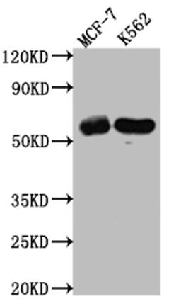 Western Blot. Positive WB detected in: MCF-7 whole cell lysate, K562 whole cell lysate. All lanes: HDAC2 antibody at 1:1000. Secondary. Goat polyclonal to rabbit IgG at 1/50000 dilution. Predicted band size: 56, 52 kDa. Observed band size: 60 kDa. 