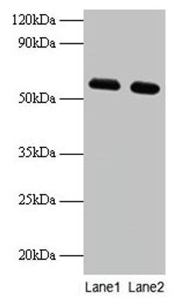 Western blot. All lanes: PHGDH antibody at 2µg/ml. Lane 1: EC109 whole cell lysate. Lane 2: 293T whole cell lysate. Secondary. Goat polyclonal to rabbit IgG at 1/15000 dilution. Predicted band size: 57 kDa. Observed band size: 57 kDa