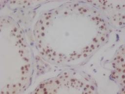 IHC image of CSB-RA694283A0HU diluted at 1:100 and staining in paraffin-embedded human testis tissue performed on a Leica BondTM system. After dewaxing and hydration, antigen retrieval was mediated by high pressure in a citrate buffer (pH 6.0). Section was blocked with 10% normal goat serum 30min at RT. Then primary antibody (1% BSA) was incubated at 4°C overnight. The primary is detected by a Goat anti-rabbit polymer IgG labeled by HRP and visualized using 0.05% DAB.
