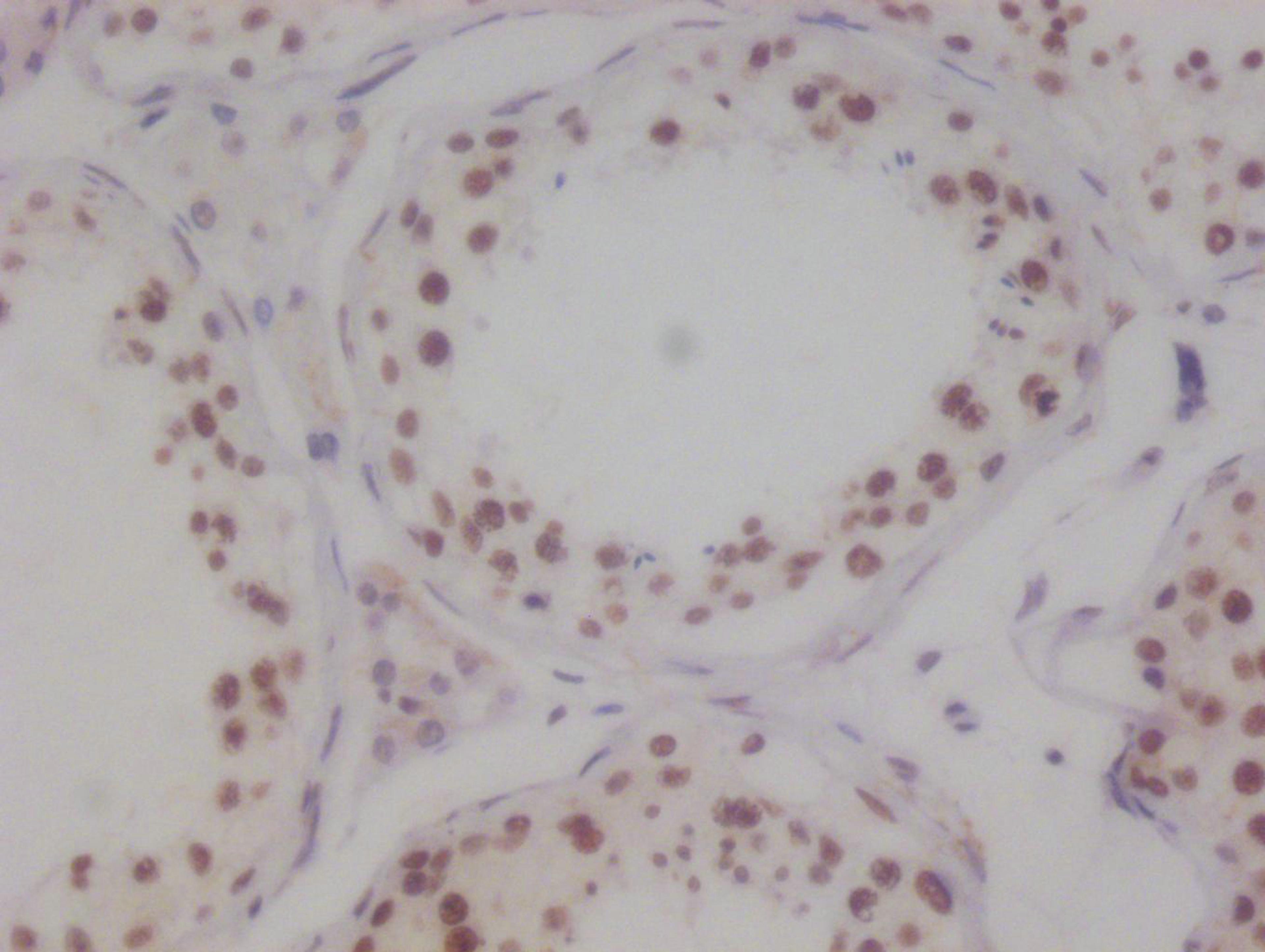 IHC image of CSB-RA694283A0HU diluted at 1:100 and staining in paraffin-embedded human testis tissue performed on a Leica BondTM system. After dewaxing and hydration, antigen retrieval was mediated by high pressure in a citrate buffer (pH 6.0). Section was blocked with 10% normal goat serum 30min at RT. Then primary antibody (1% BSA) was incubated at 4°C overnight. The primary is detected by a Goat anti-rabbit polymer IgG labeled by HRP and visualized using 0.05% DAB.