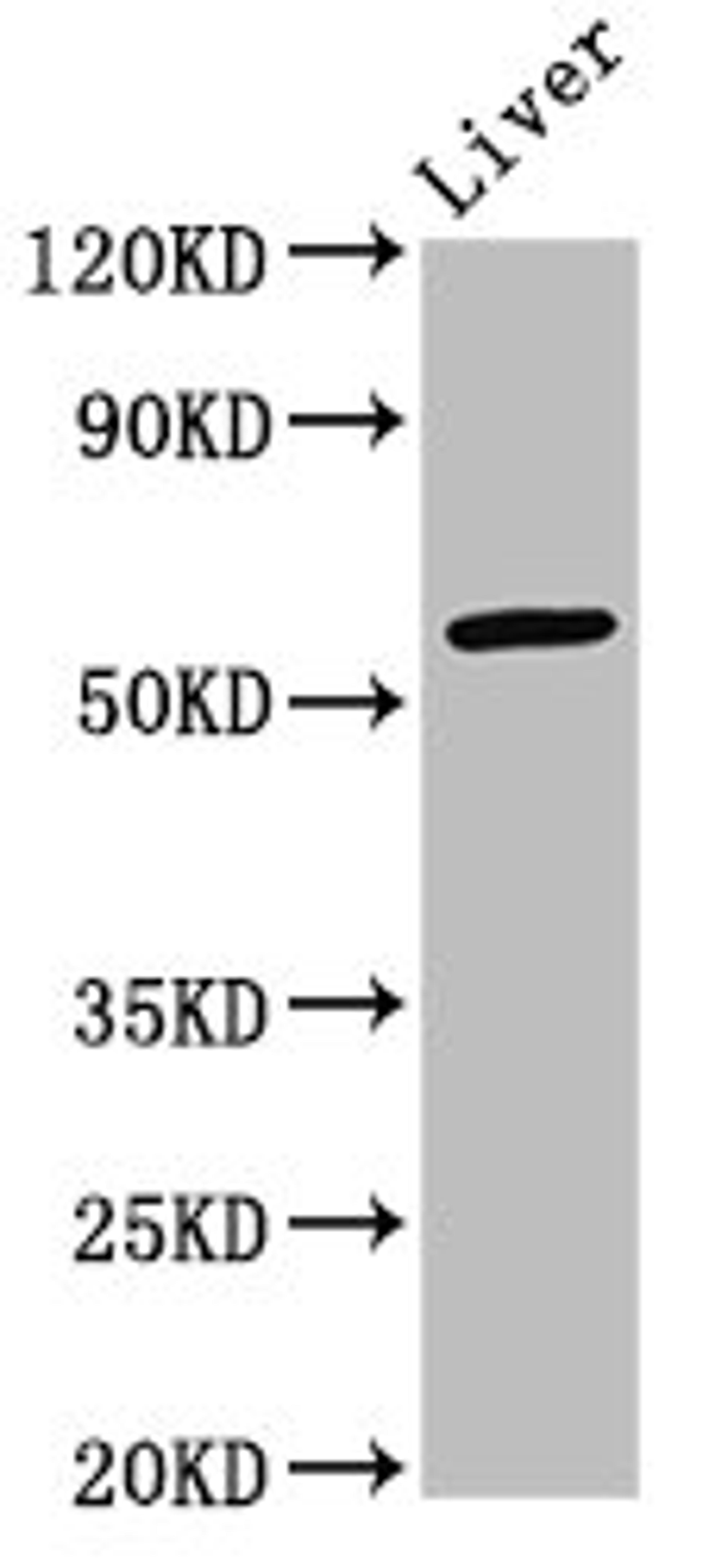 Western Blot. Positive WB detected in: Mouse liver tissue. All lanes: ARID3A antibody at 2.7ug/ml. Secondary. Goat polyclonal to rabbit IgG at 1/50000 dilution. Predicted band size: 63 kDa. Observed band size: 63 kDa.