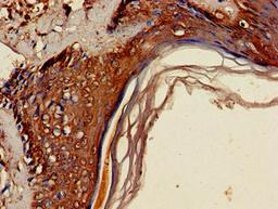 Immunohistochemistry of paraffin-embedded human skin tissue using CSB-PA718355LA01HU at dilution of 1:100