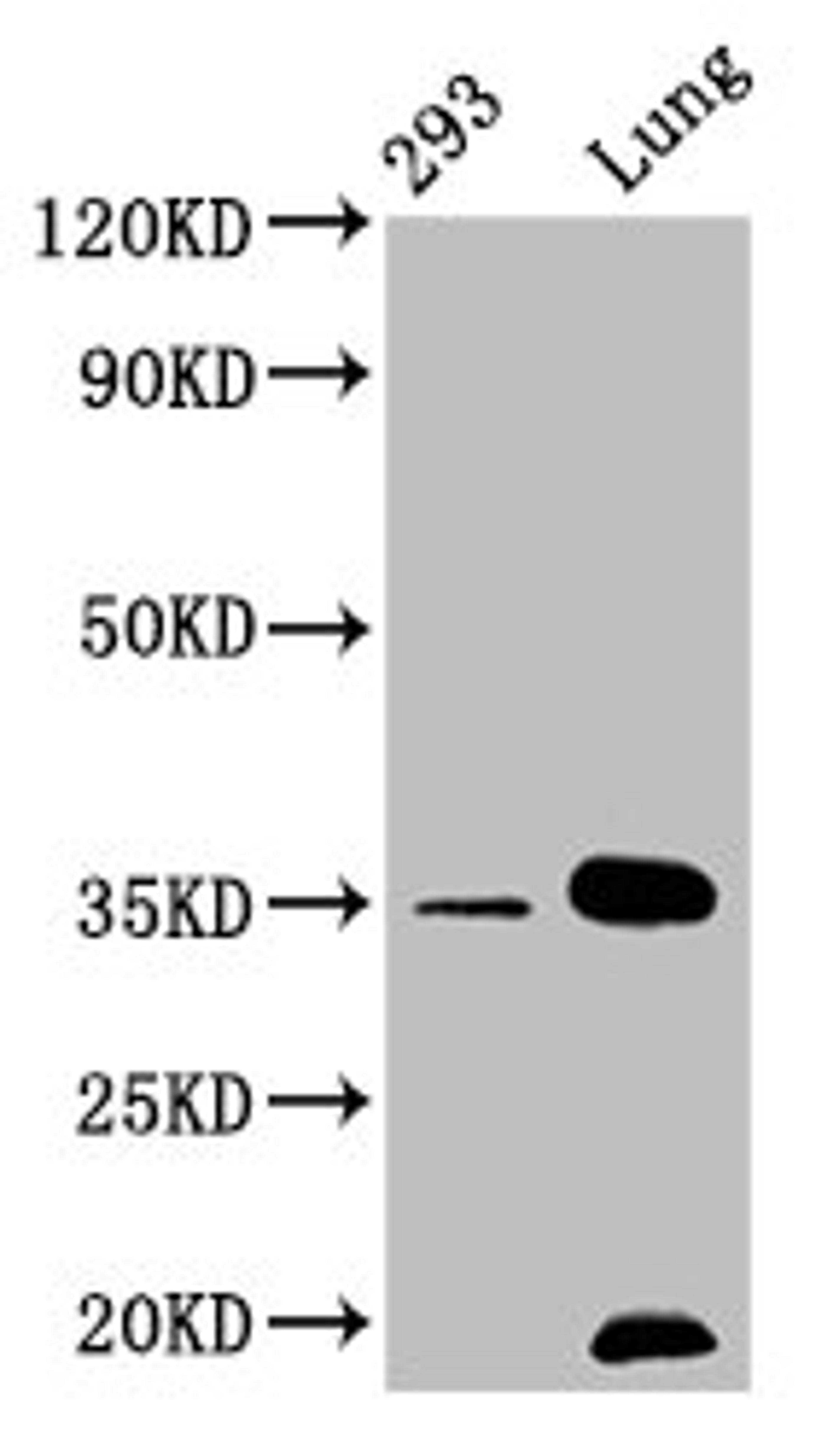 Western Blot. Positive WB detected in: 293 whole cell lysate, Mouse lung tissue. All lanes: CNN1 antibody at 1.05μg/ml. Secondary. Goat polyclonal to rabbit IgG at 1/50000 dilution. Predicted band size: 34, 32 KDa. Observed band size: 34 KDa.