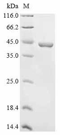 (Tris-Glycine gel) Discontinuous SDS-PAGE (reduced) with 5% enrichment gel and 15% separation gel.