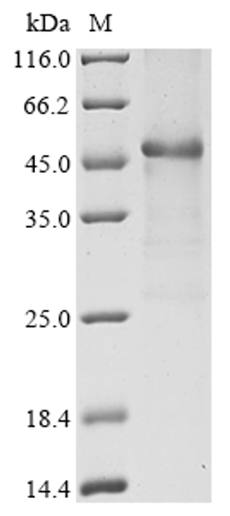 (Tris-Glycine gel) Discontinuous SDS-PAGE (reduced) with 5% enrichment gel and 15% separation gel.