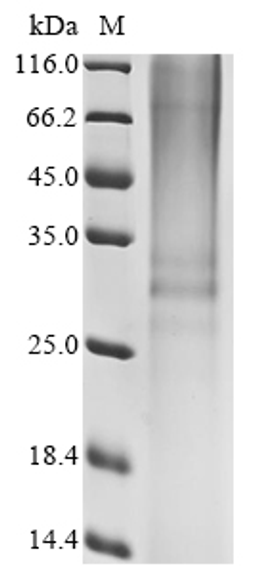 (Tris-Glycine gel) Discontinuous SDS-PAGE (reduced) with 5% enrichment gel and 15% separation gel.