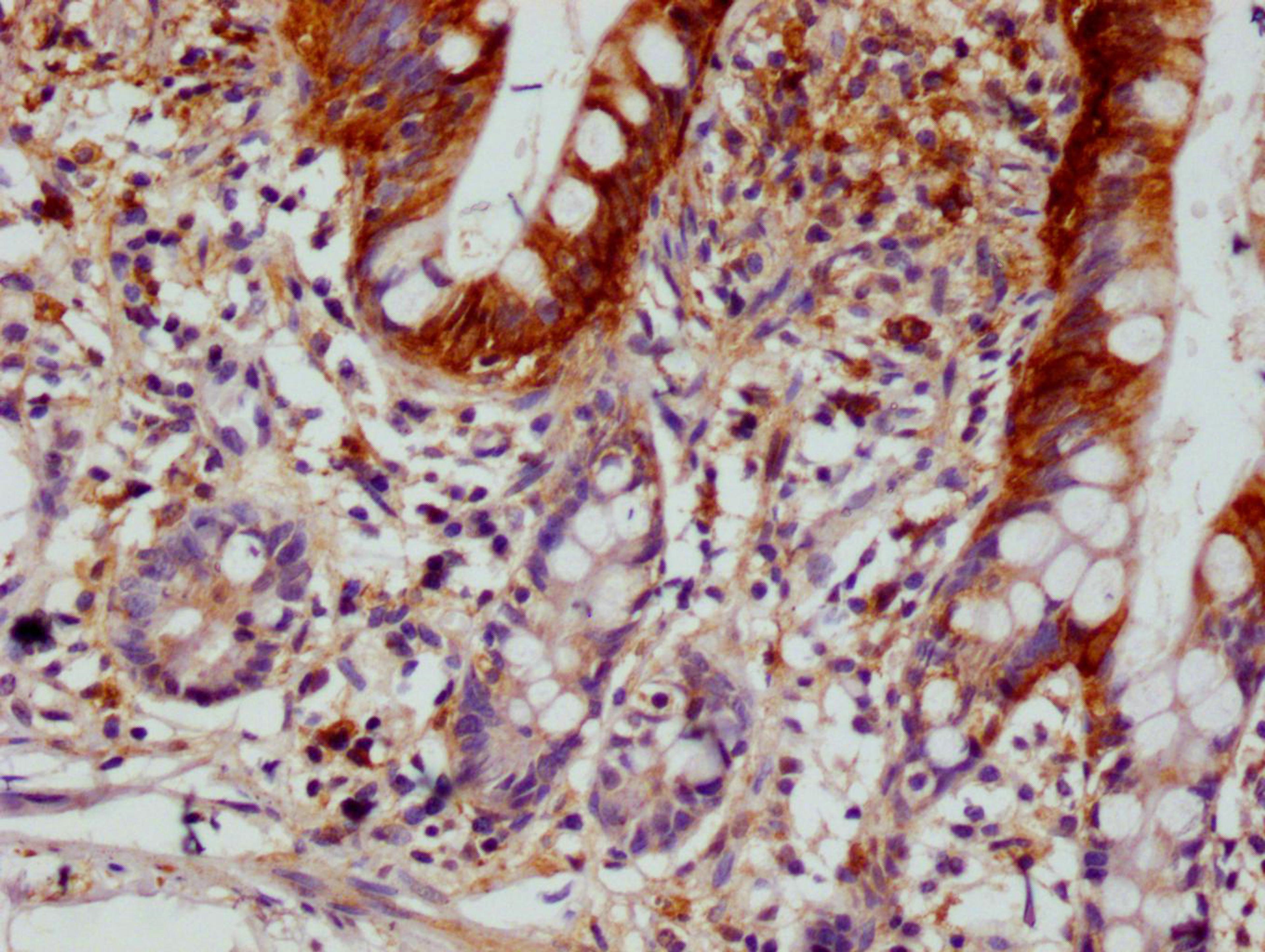 IHC image of CSB-RA213020A0HU diluted at 1:100 and staining in paraffin-embedded human small intestine tissue performed on a Leica BondTM system. After dewaxing and hydration, antigen retrieval was mediated by high pressure in a citrate buffer (pH 6.0). Section was blocked with 10% normal goat serum 30min at RT. Then primary antibody (1% BSA) was incubated at 4°C overnight. The primary is detected by a Goat anti-rabbit polymer IgG labeled by HRP and visualized using 0.05% DAB.