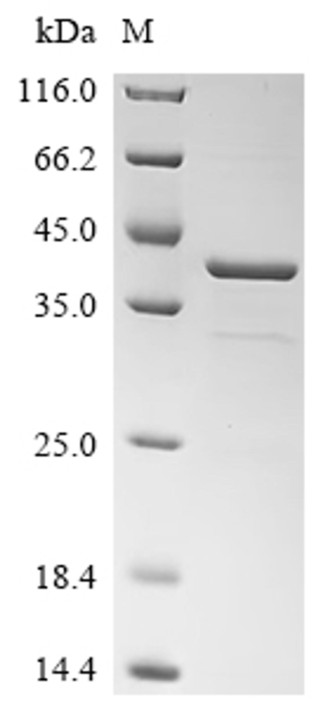 (Tris-Glycine gel) Discontinuous SDS-PAGE (reduced) with 5% enrichment gel and 15% separation gel.
