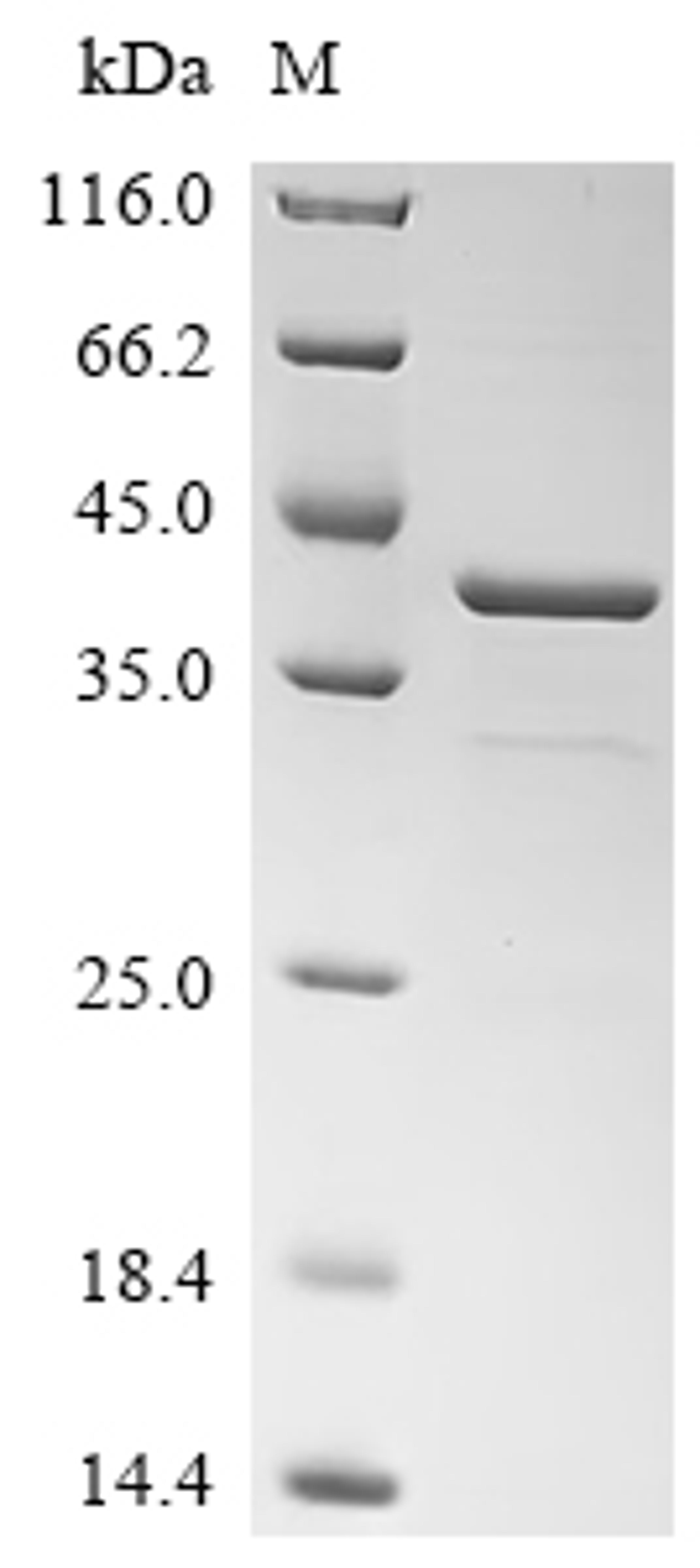 (Tris-Glycine gel) Discontinuous SDS-PAGE (reduced) with 5% enrichment gel and 15% separation gel.
