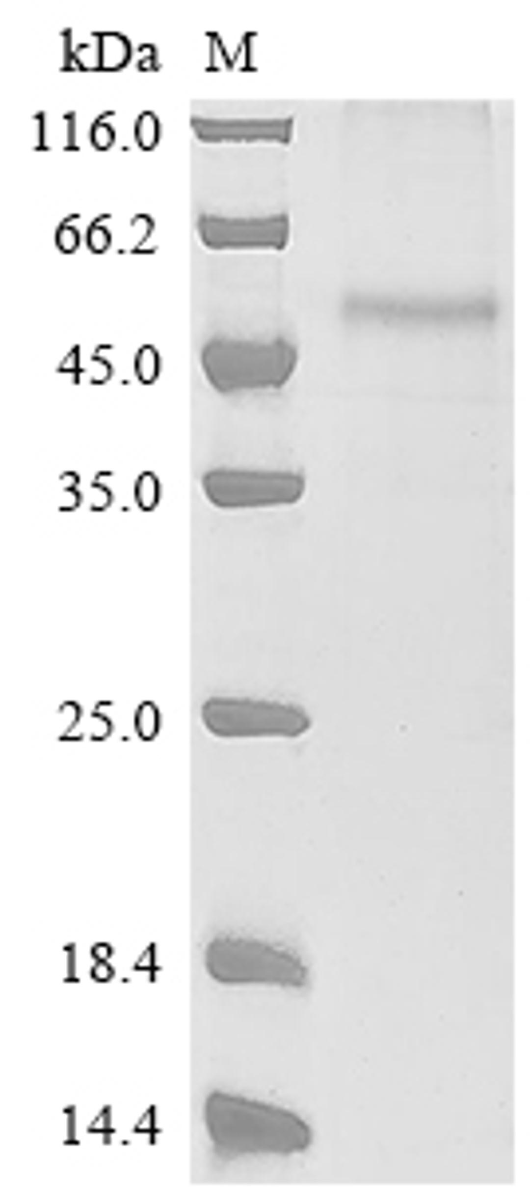 (Tris-Glycine gel) Discontinuous SDS-PAGE (reduced) with 5% enrichment gel and 15% separation gel.