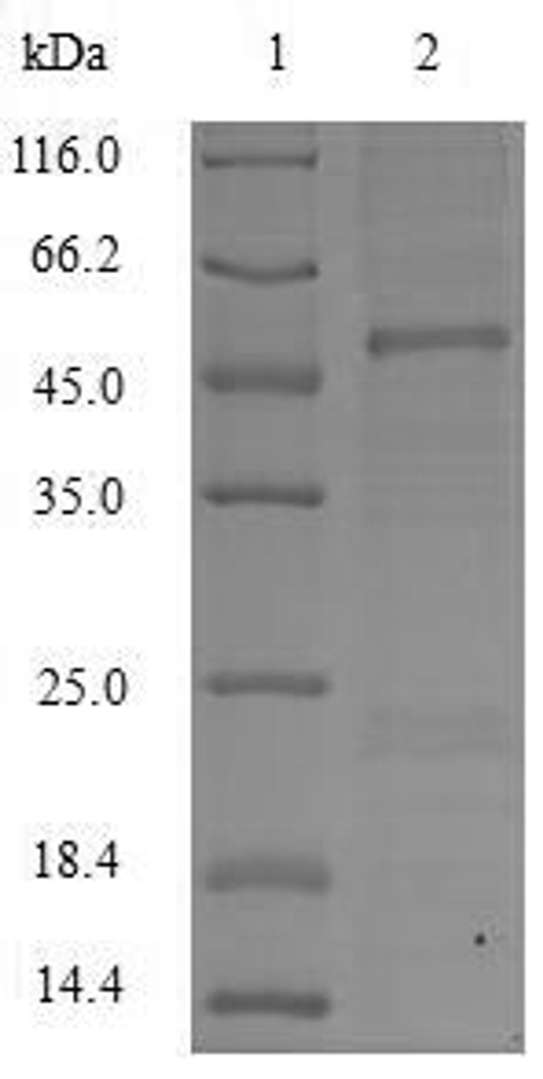 (Tris-Glycine gel) Discontinuous SDS-PAGE (reduced) with 5% enrichment gel and 15% separation gel.
