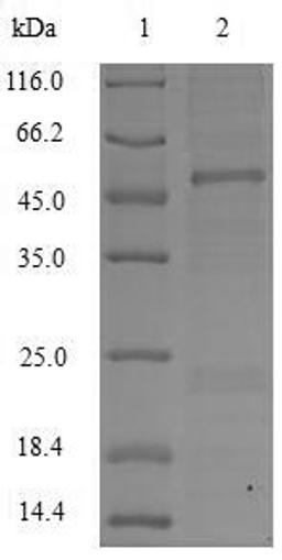 (Tris-Glycine gel) Discontinuous SDS-PAGE (reduced) with 5% enrichment gel and 15% separation gel.