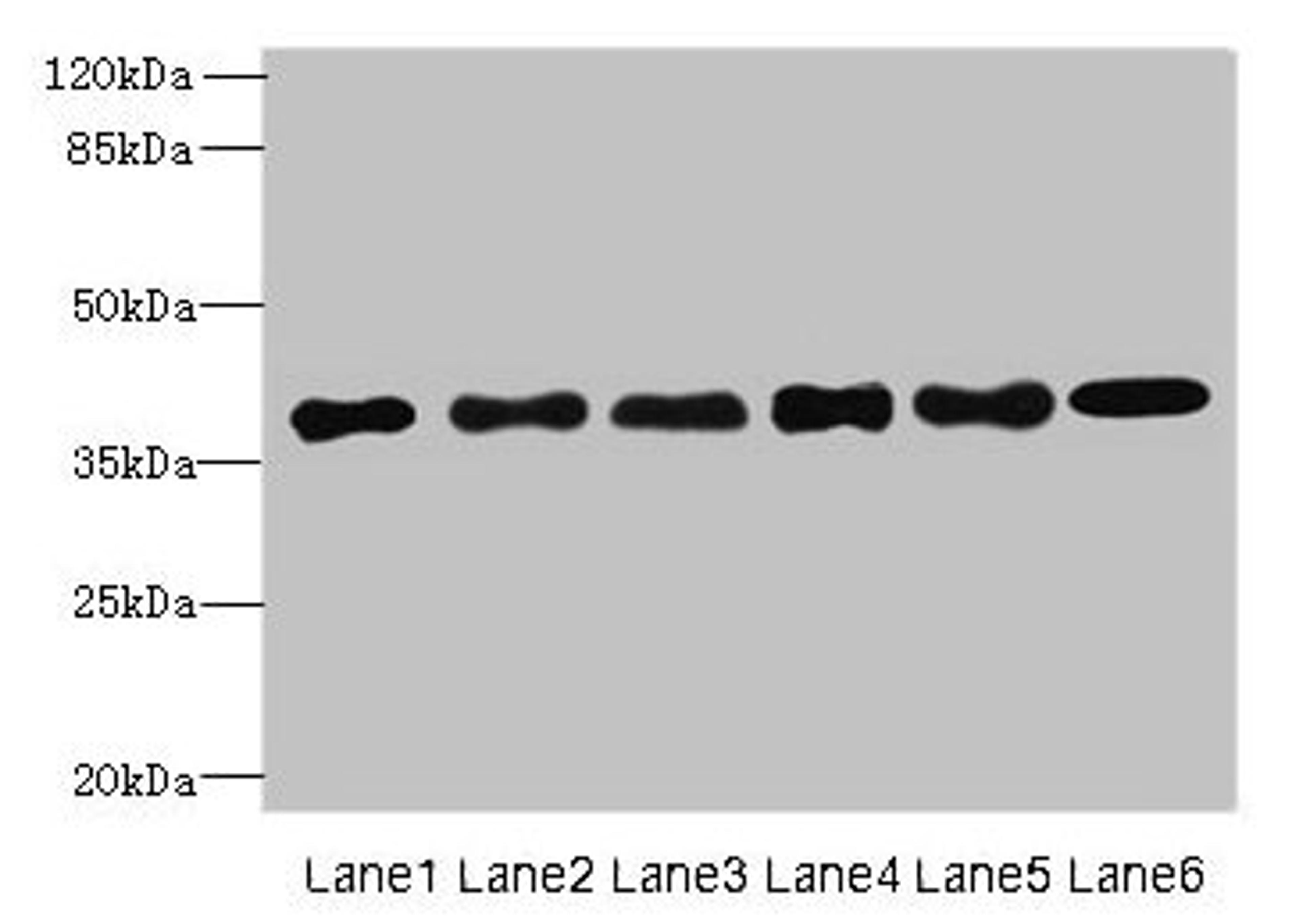 Western blot. All lanes: TMEM68 antibody at 4µg/ml. Lane 1: Mouse thymus tissue. Lane 2: K562 whole cell lysate. Lane 3: U251 whole cell lysate. Lane 4: HepG2 whole cell lysate. Lane 5: MCF-7 whole cell lysate. Lane 6: Jurkat whole cell lysate. Secondary. Goat polyclonal to rabbit IgG at 1/10000 dilution. Predicted band size: 38, 30, 16 kDa. Observed band size: 38 kDa