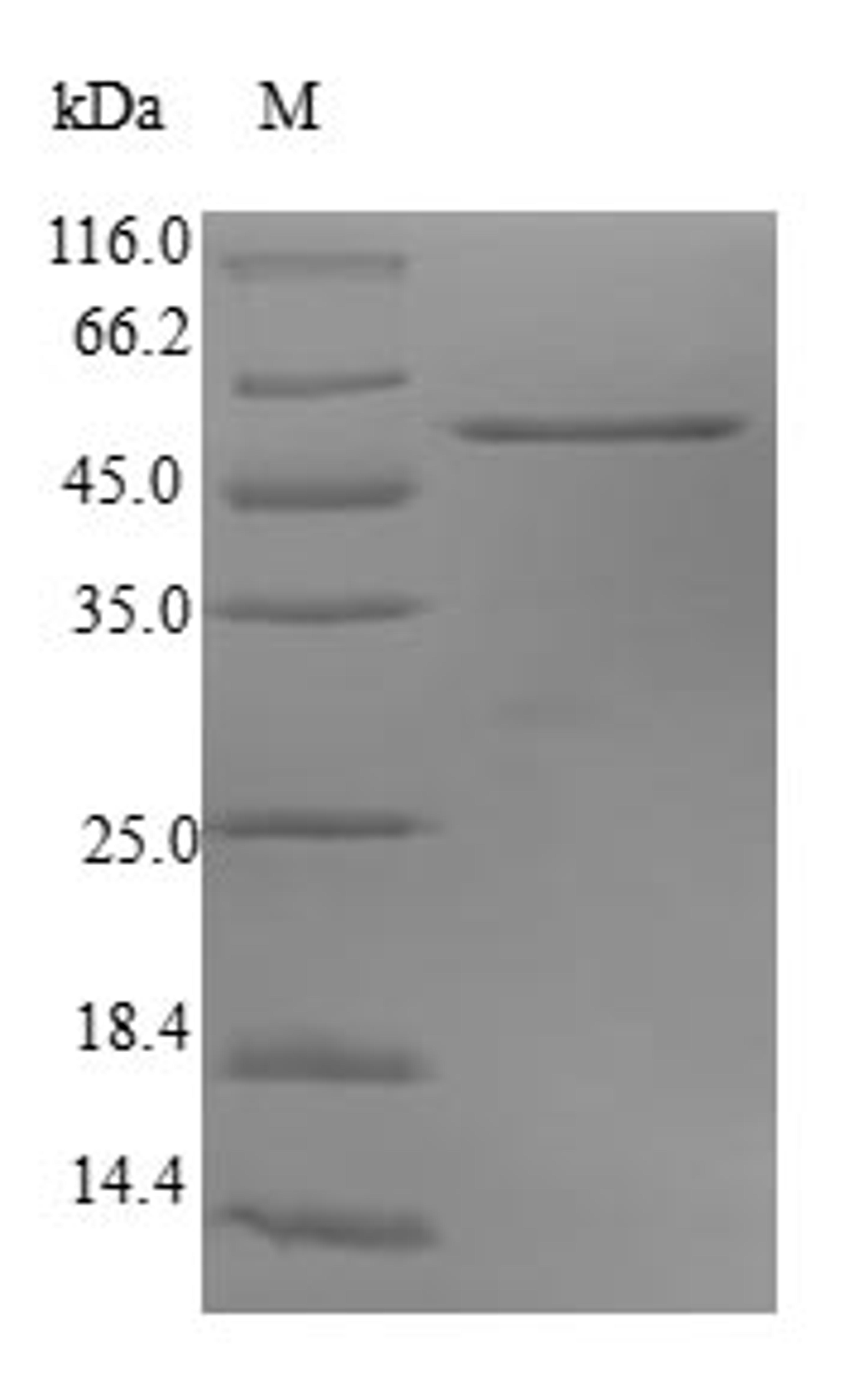 (Tris-Glycine gel) Discontinuous SDS-PAGE (reduced) with 5% enrichment gel and 15% separation gel.