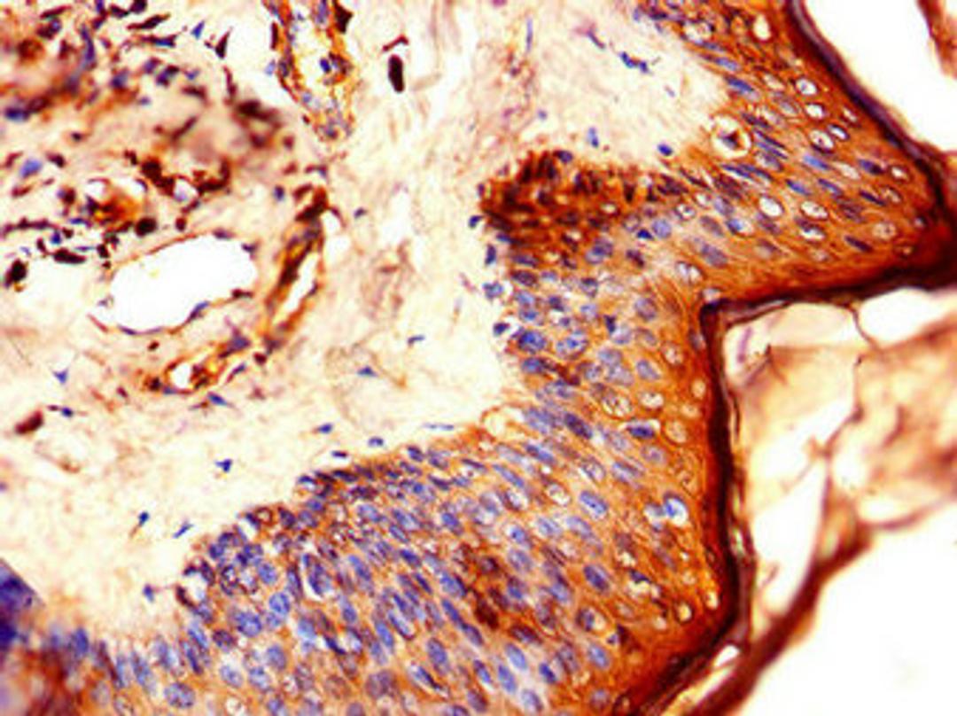 Immunohistochemistry of paraffin-embedded human skin tissue using CSB-PA012785LA01HU at dilution of 1:100