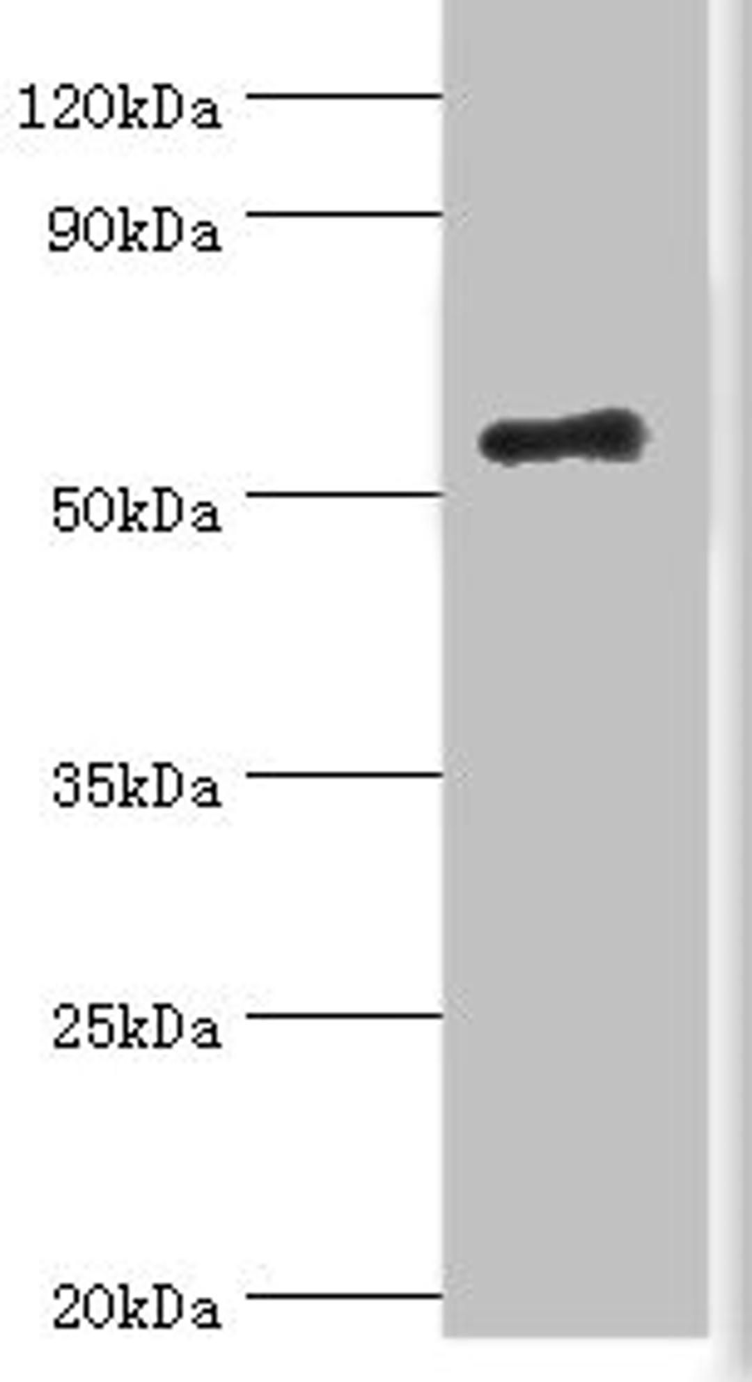 Western blot. All lanes: Zinc finger protein Aiolos antibody at 8ug/ml + HepG2 whole cell lysate. Secondary. Goat polyclonal to rabbit IgG at 1/10000 dilution. Predicted band size: 59, 52, 54, 30, 48, 50, 55, 42, 36, 33, 43, 31 kDa. Observed band size: 59 kDa. 