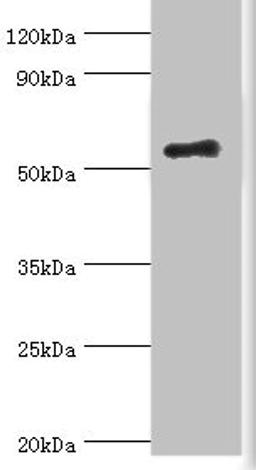 Western blot. All lanes: Zinc finger protein Aiolos antibody at 8ug/ml + HepG2 whole cell lysate. Secondary. Goat polyclonal to rabbit IgG at 1/10000 dilution. Predicted band size: 59, 52, 54, 30, 48, 50, 55, 42, 36, 33, 43, 31 kDa. Observed band size: 59 kDa. 