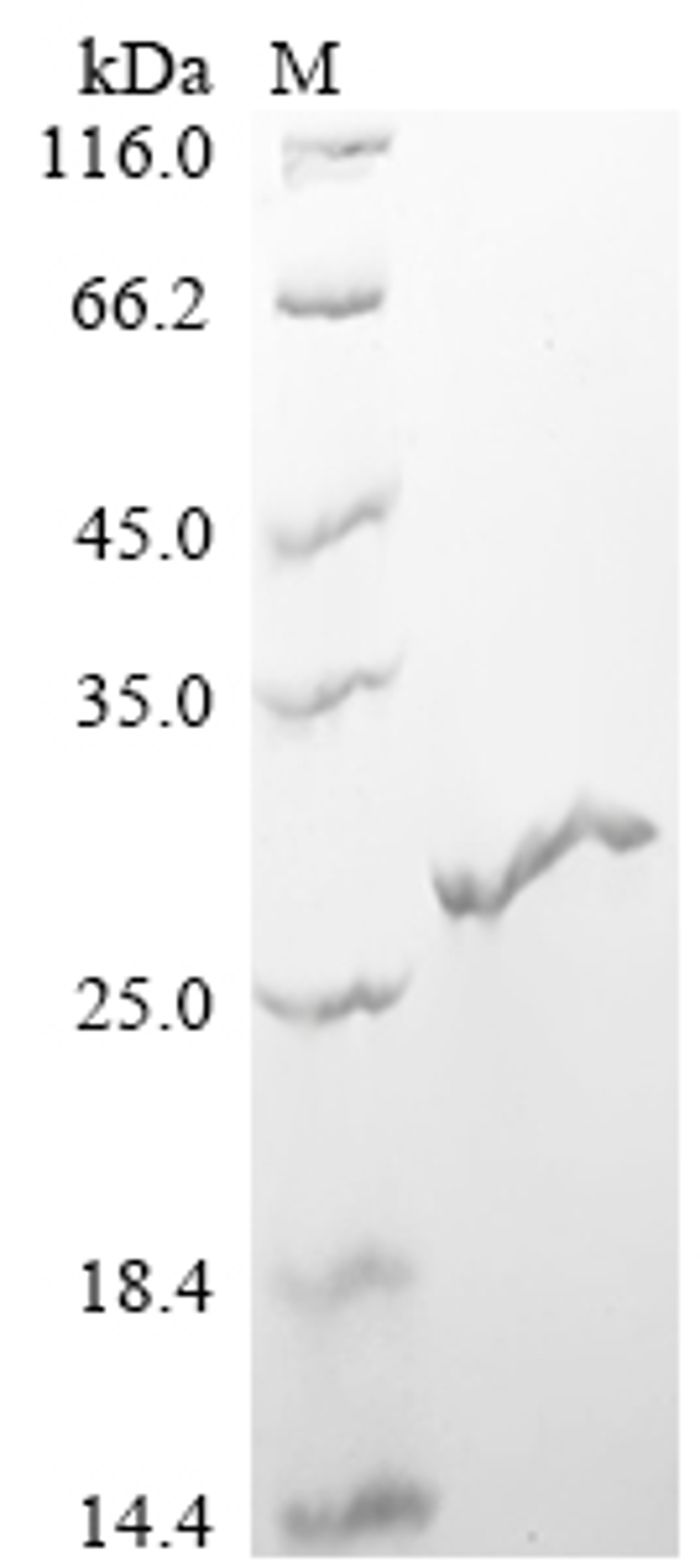 (Tris-Glycine gel) Discontinuous SDS-PAGE (reduced) with 5% enrichment gel and 15% separation gel.