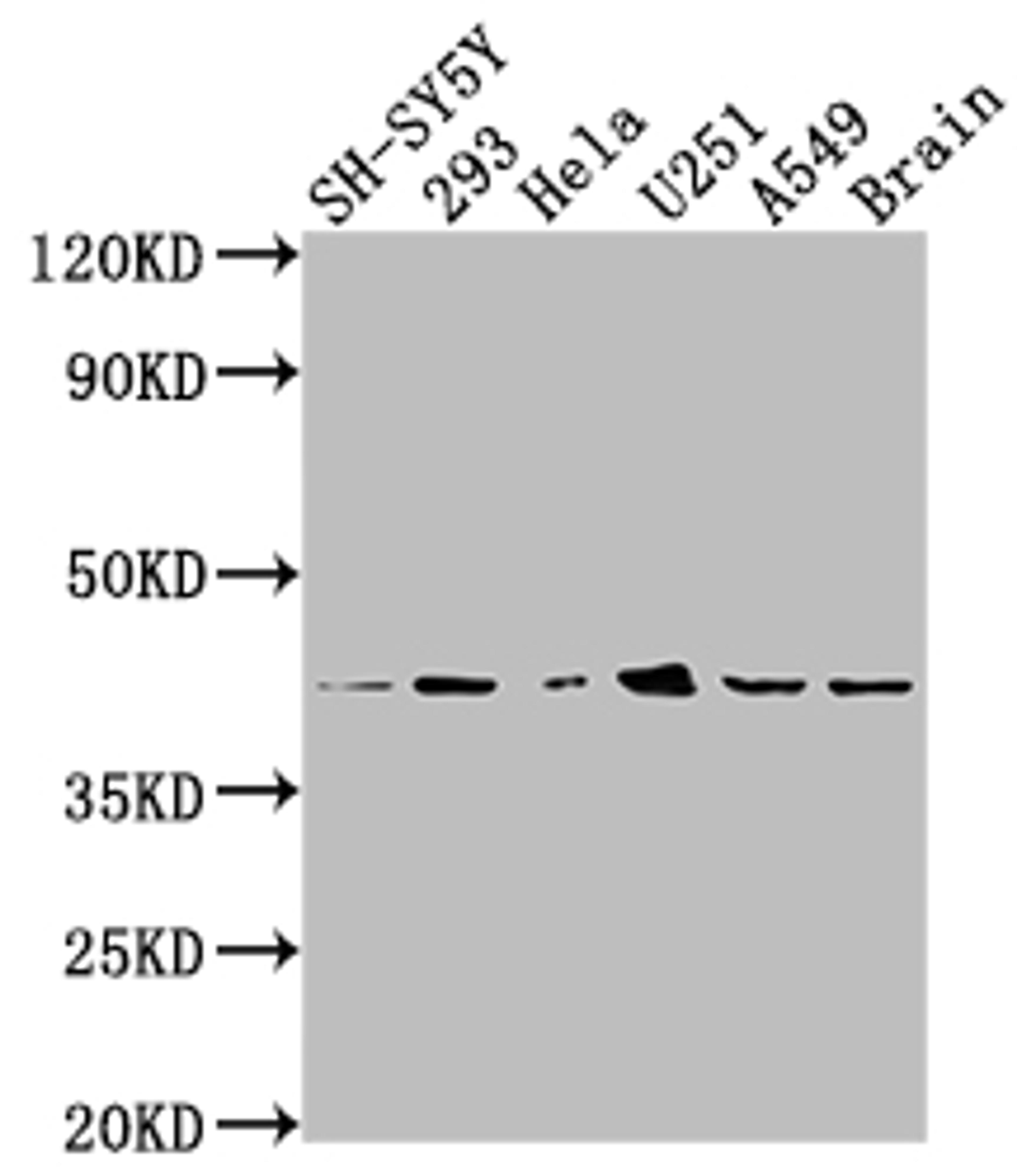 Western Blot. Positive WB detected in: SH-SY5Y whole cell lysate, 293 whole cell lysate, Hela whole cell lysate, U251 whole cell lysate, A549 whole cell lysate, Mouse brain tissue. All lanes: OPRD1 antibody at 1:2000. Secondary. Goat polyclonal to rabbit IgG at 1/50000 dilution. Predicted band size: 41 kDa. Observed band size: 41 kDa. 