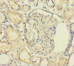 Immunohistochemistry of paraffin-embedded human kidney tissue using CSB-PA009608LA01HU at dilution of 1:100