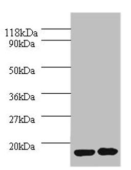 Western blot. All lanes: IL1RN antibody at 2µg/ml. Lane 1: EC109 whole cell lysate. Lane 2: 293T whole cell lysate. Secondary. Goat polyclonal to rabbit IgG at 1/10000 dilution. Predicted band size: 21, 18, 20, 17 kDa. Observed band size: 17 kDa