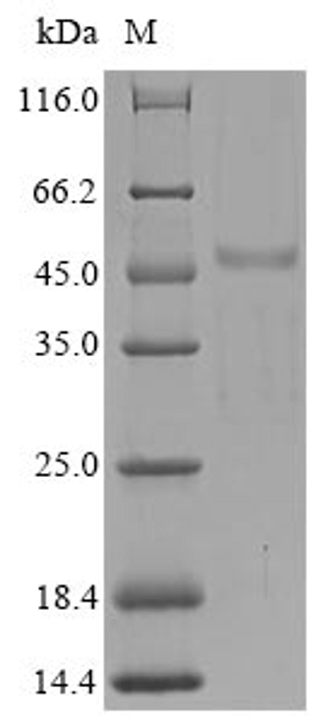 (Tris-Glycine gel) Discontinuous SDS-PAGE (reduced) with 5% enrichment gel and 15% separation gel.
