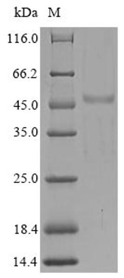 (Tris-Glycine gel) Discontinuous SDS-PAGE (reduced) with 5% enrichment gel and 15% separation gel.