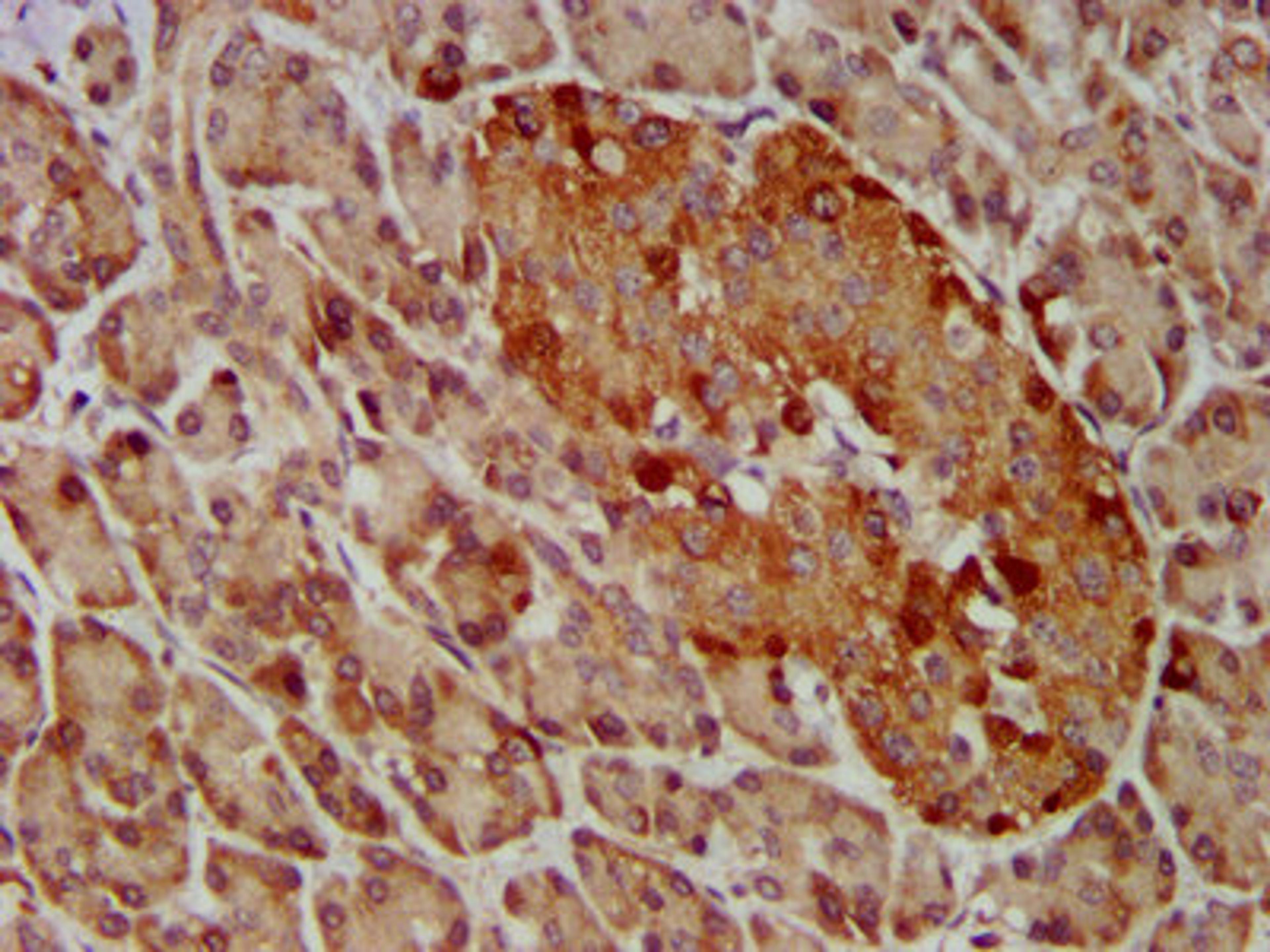 IHC image of CSB-PA009363LA01HU diluted at 1:400 and staining in paraffin-embedded human pancreatic tissue performed on a Leica BondTM system. After dewaxing and hydration, antigen retrieval was mediated by high pressure in a citrate buffer (pH 6.0). Section was blocked with 10% normal goat serum 30min at RT. Then primary antibody (1% BSA) was incubated at 4&deg;C overnight. The primary is detected by a biotinylated secondary antibody and visualized using an HRP conjugated SP system.