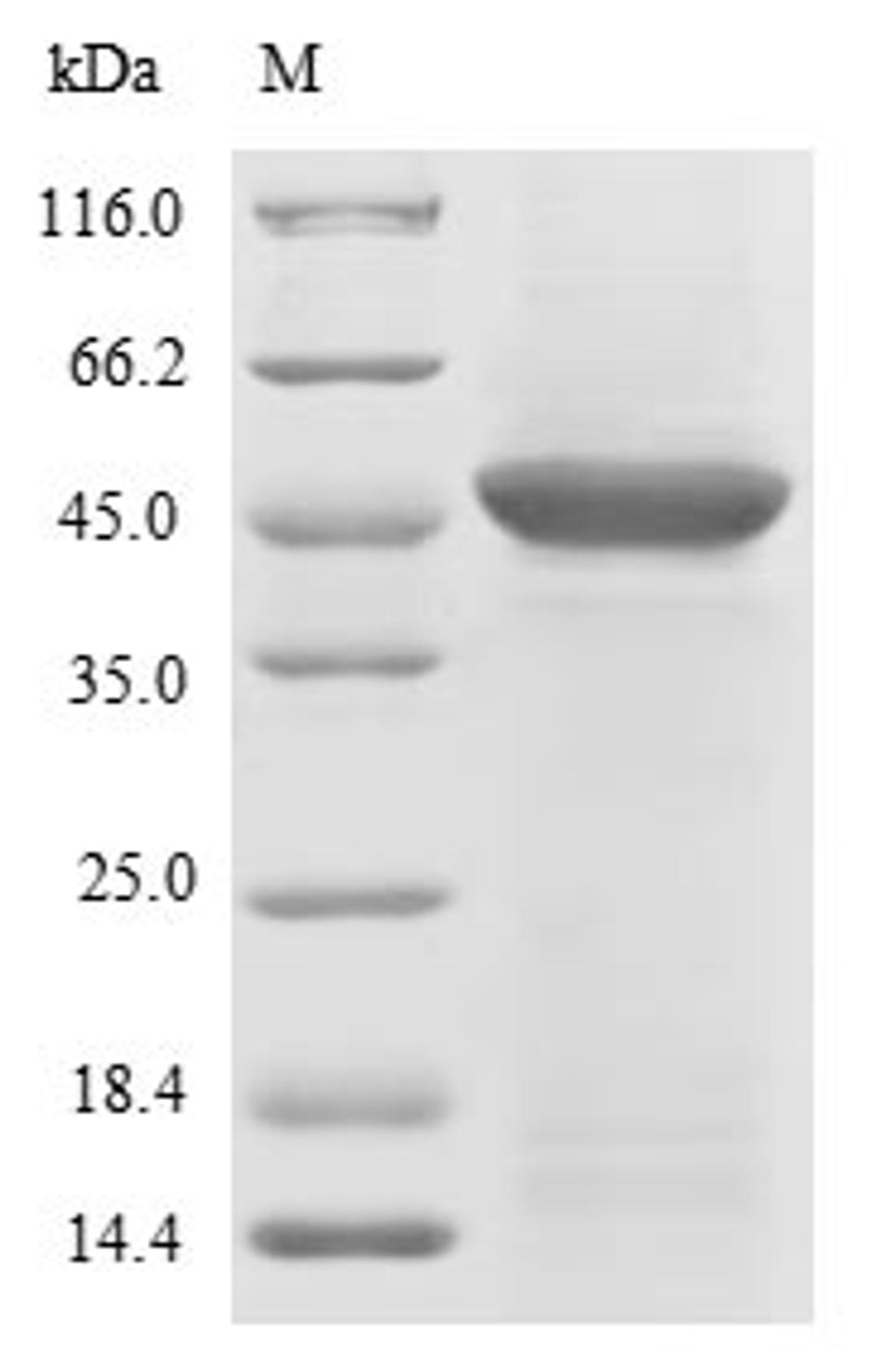 (Tris-Glycine gel) Discontinuous SDS-PAGE (reduced) with 5% enrichment gel and 15% separation gel.