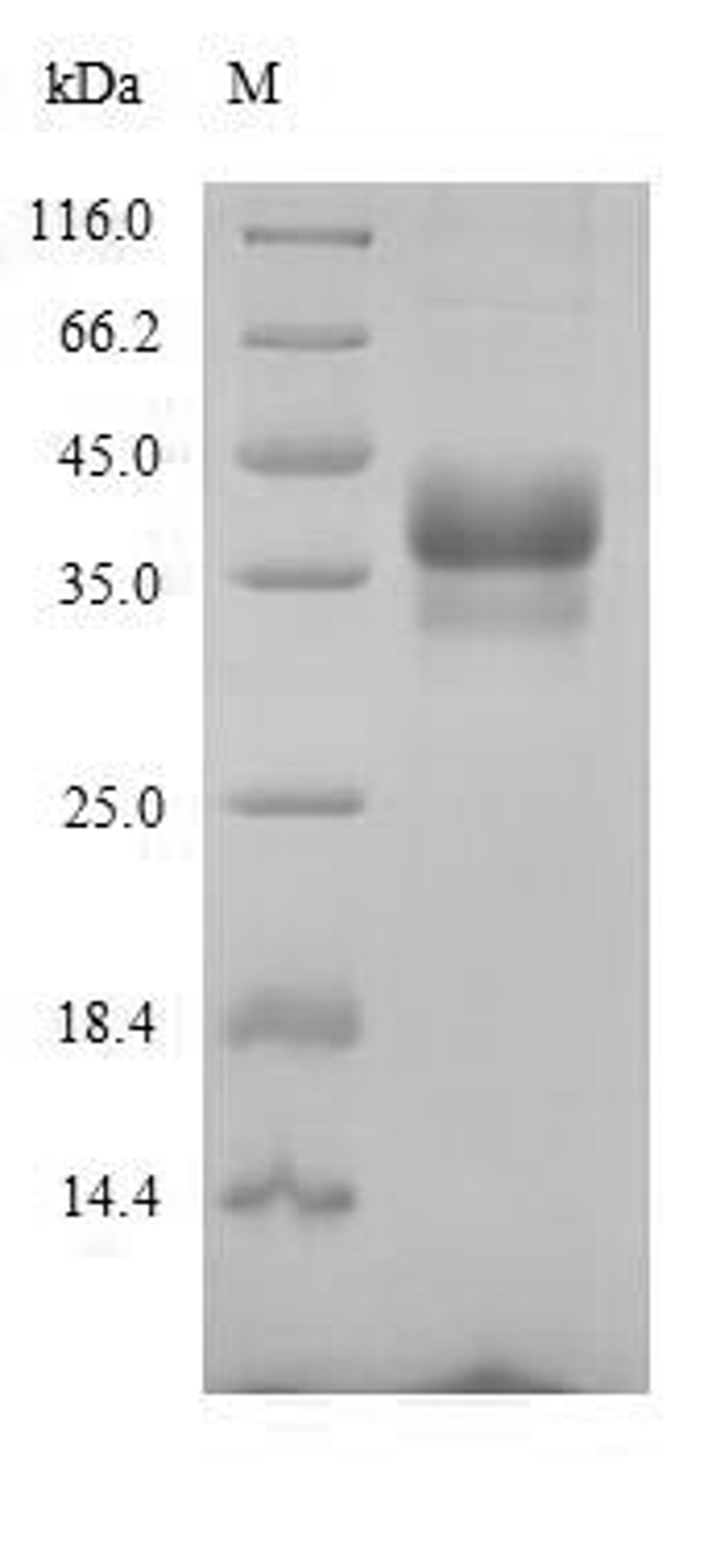 (Tris-Glycine gel) Discontinuous SDS-PAGE (reduced) with 5% enrichment gel and 15% separation gel.