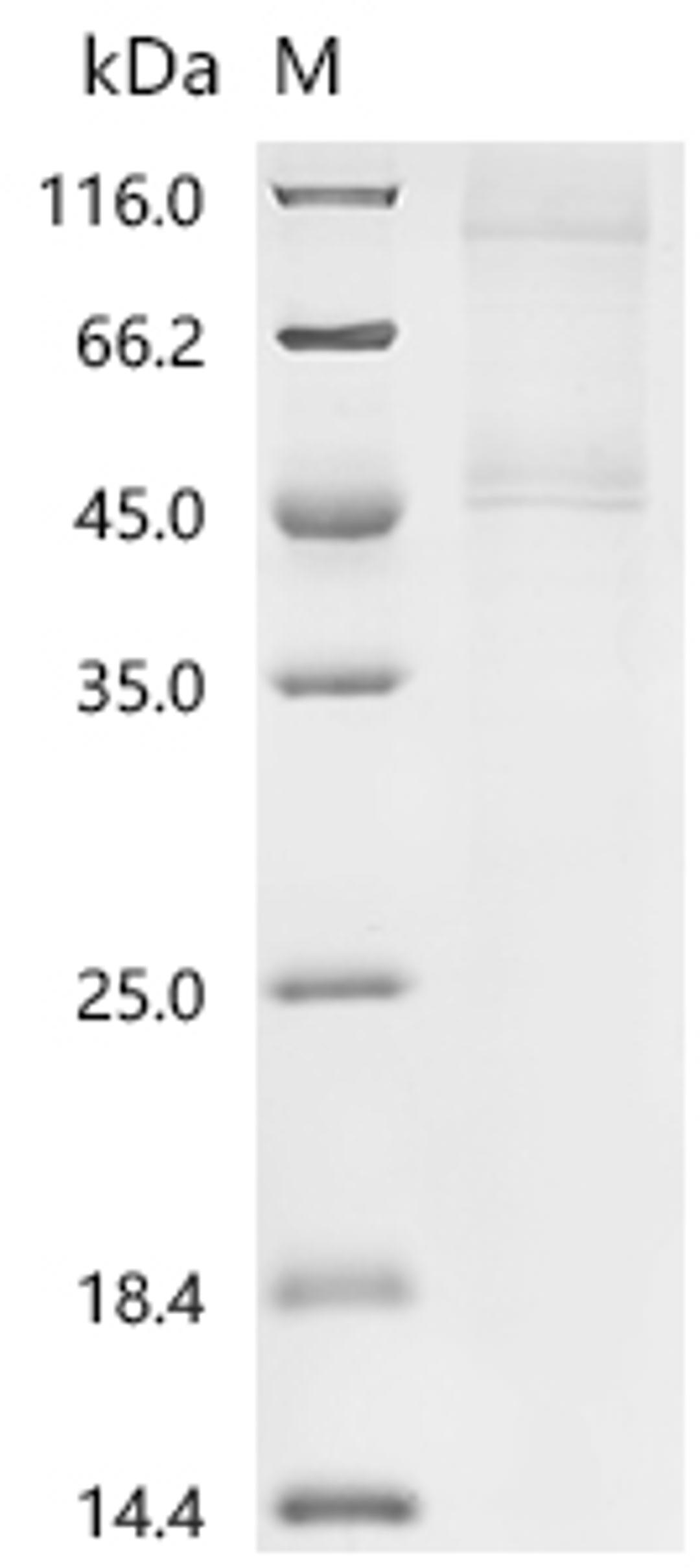 (Tris-Glycine gel) Discontinuous SDS-PAGE (reduced) with 5% enrichment gel and 15% separation gel.