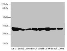 Western blot. All lanes: ECHS1 antibody at 3.55µg/ml. Lane 1: Rat heart tissue. Lane 2: Mouse liver tissue. Lane 3: Mouse skeletal muscle tissue. Lane 4: Hela whole cell lysate. Lane 5: HepG2 whole cell lysate. Lane 6: MCF-7 whole cell lysate. Lane 7: Jurkat whole cell lysate. Lane 8: A549 whole cell lysate. Secondary. Goat polyclonal to rabbit IgG at 1/10000 dilution. Predicted band size: 32 kDa. Observed band size: 32 kDa