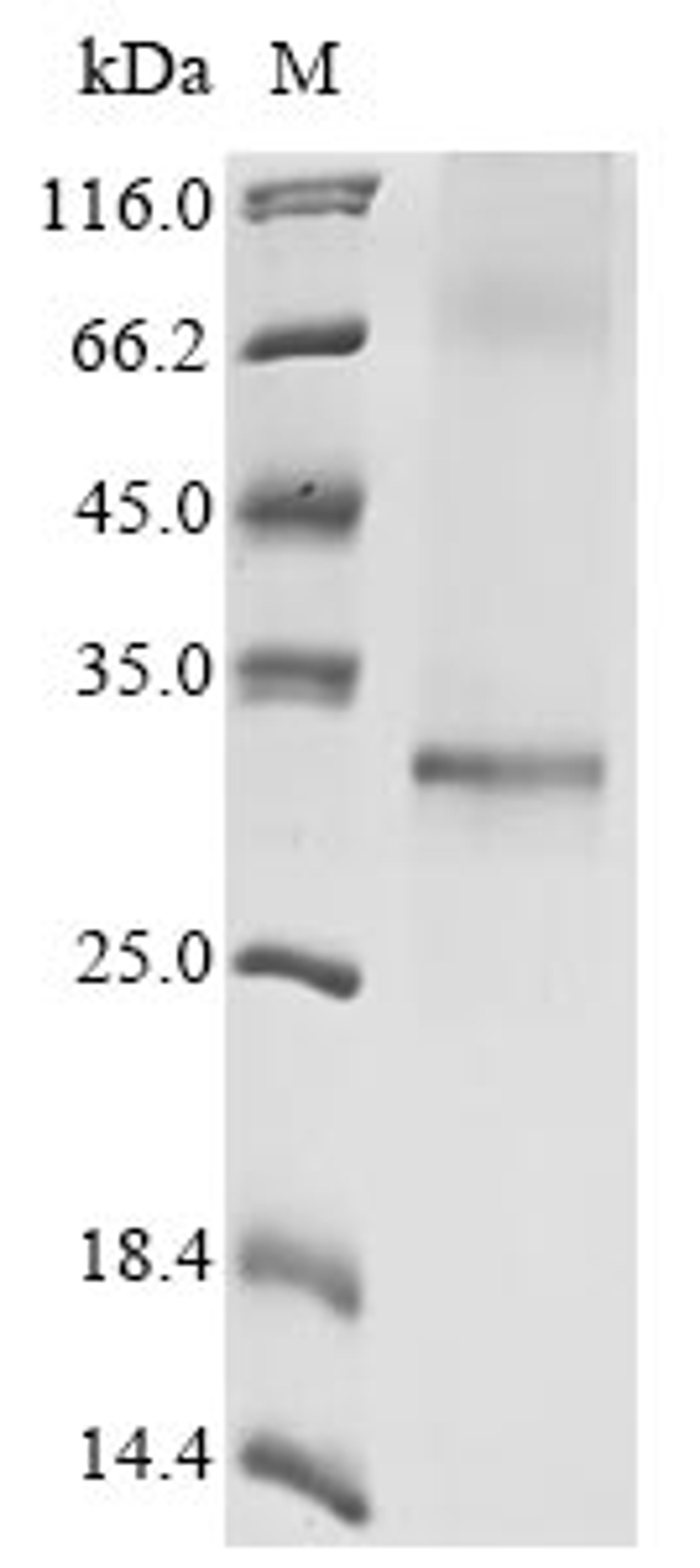 (Tris-Glycine gel) Discontinuous SDS-PAGE (reduced) with 5% enrichment gel and 15% separation gel.