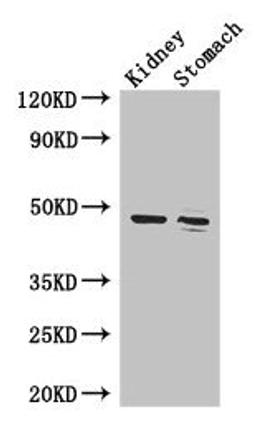 Western Blot. Positive WB detected in: Mouse kidney tissue, Mouse stomach tissue. All lanes: FAH antibody at 3.4µg/ml. Secondary. Goat polyclonal to rabbit IgG at 1/50000 dilution. Predicted band size: 47, 39 kDa. Observed band size: 47 kDa