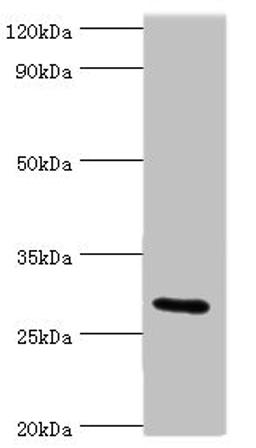 Western blot. All lanes: COLEC11 antibody at 4ug/ml + Rat liver tissue. Secondary. Goat polyclonal to rabbit IgG at 1/10000 dilution. Predicted band size: 29, 27, 22, 30, 25, 24, 31 kDa. Observed band size: 29 kDa. 