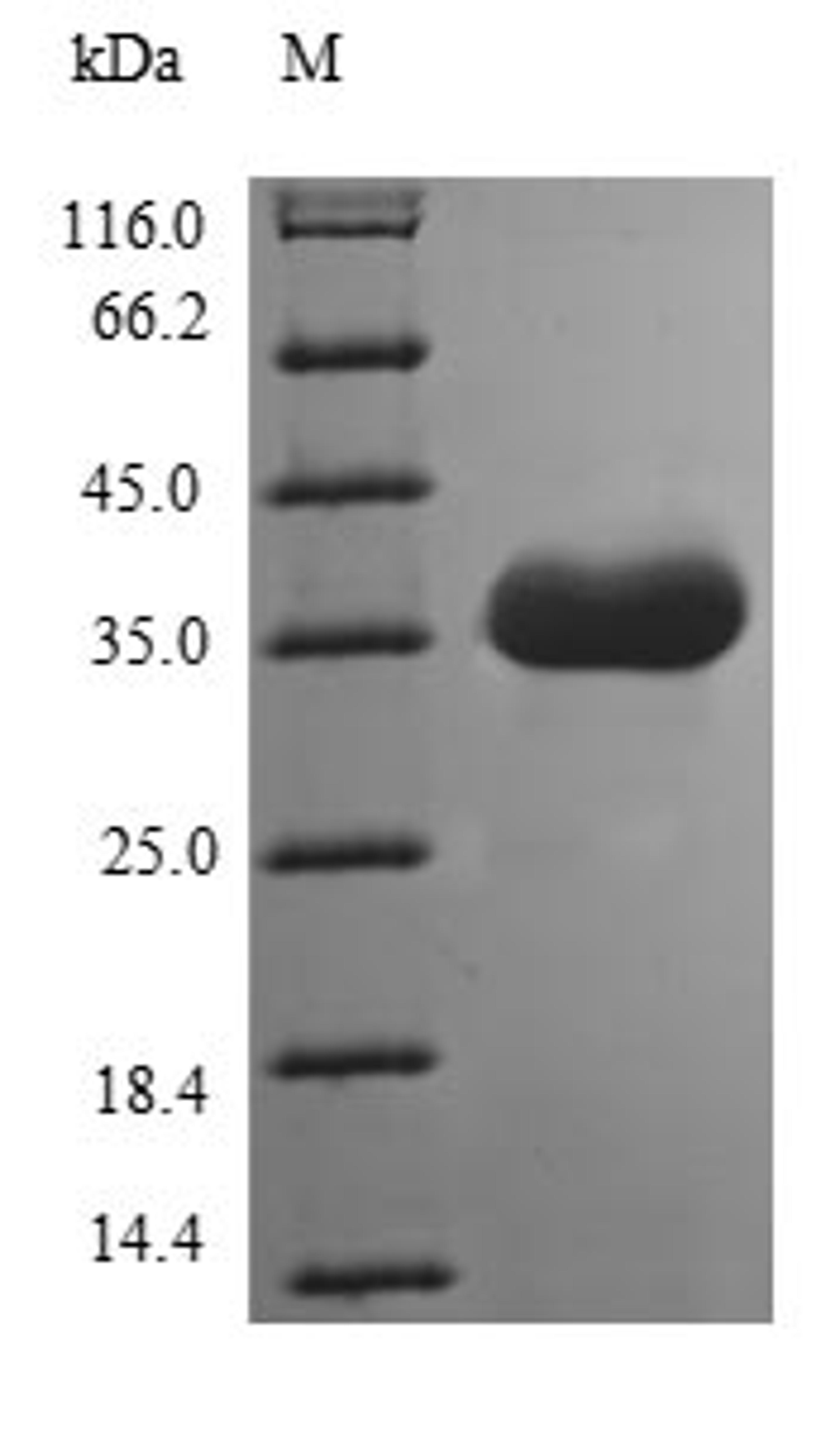 (Tris-Glycine gel) Discontinuous SDS-PAGE (reduced) with 5% enrichment gel and 15% separation gel.