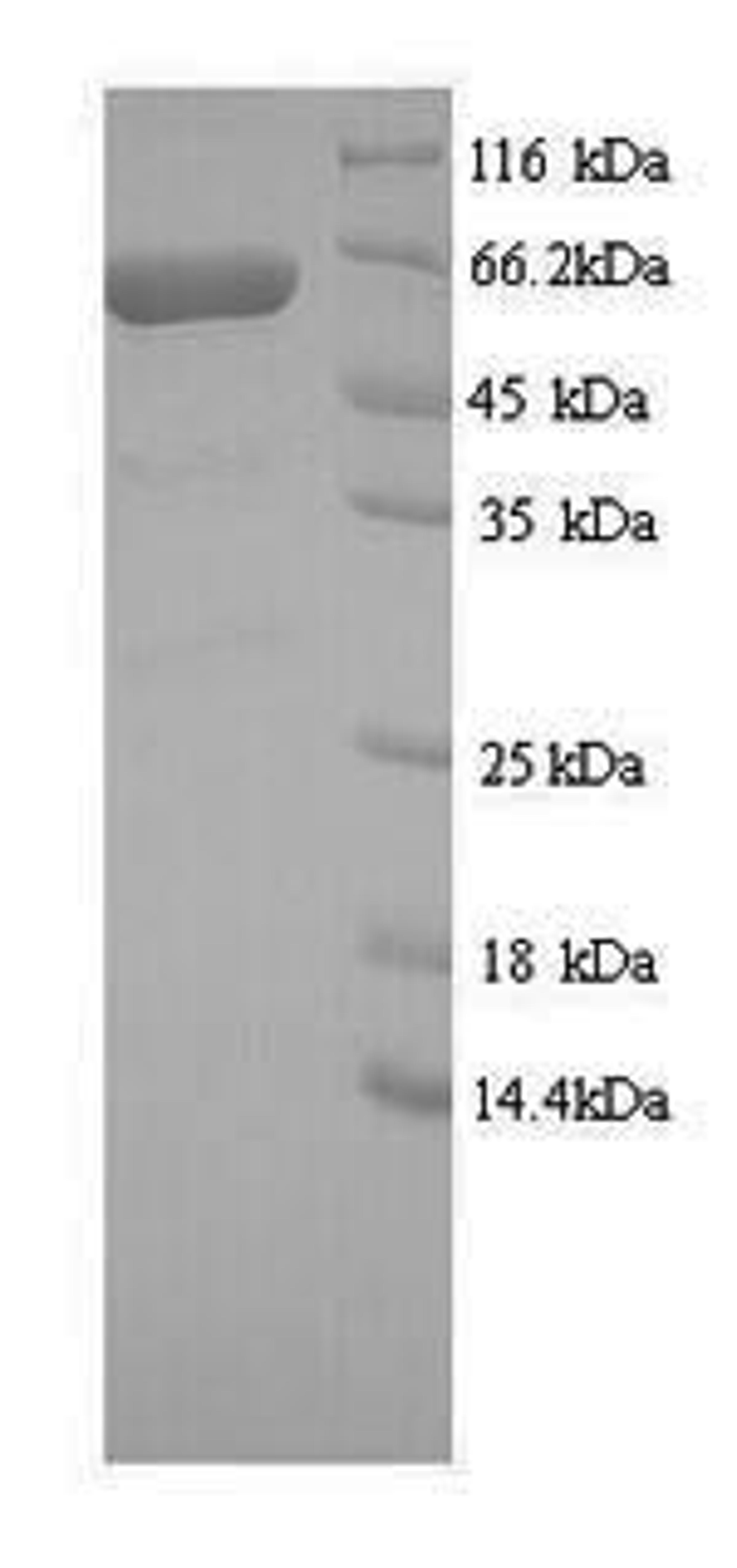 (Tris-Glycine gel) Discontinuous SDS-PAGE (reduced) with 5% enrichment gel and 15% separation gel.