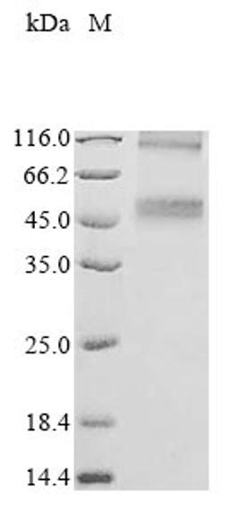 (Tris-Glycine gel) Discontinuous SDS-PAGE (reduced) with 5% enrichment gel and 15% separation gel.