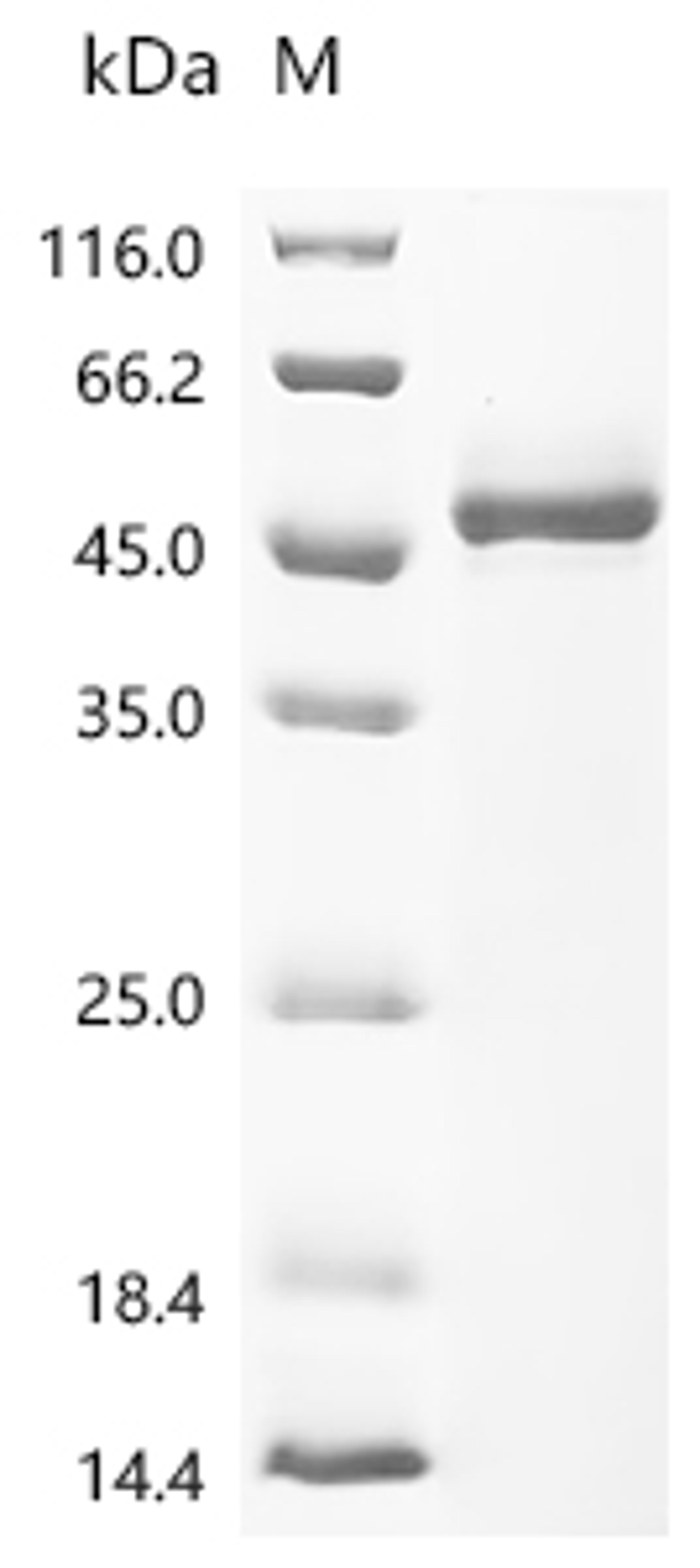 (Tris-Glycine gel) Discontinuous SDS-PAGE (reduced) with 5% enrichment gel and 15% separation gel.