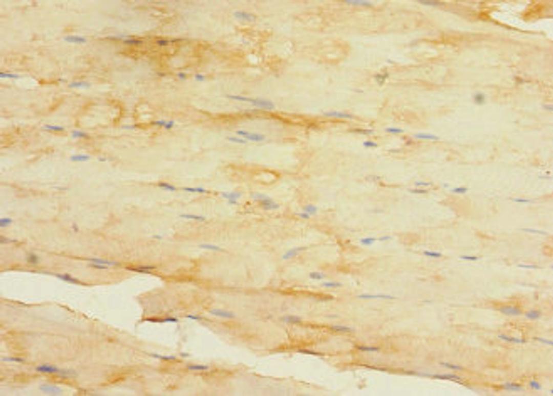 Immunohistochemistry of paraffin-embedded human skeletal muscle tissue using CSB-PA027047LA01HU at dilution of 1:100