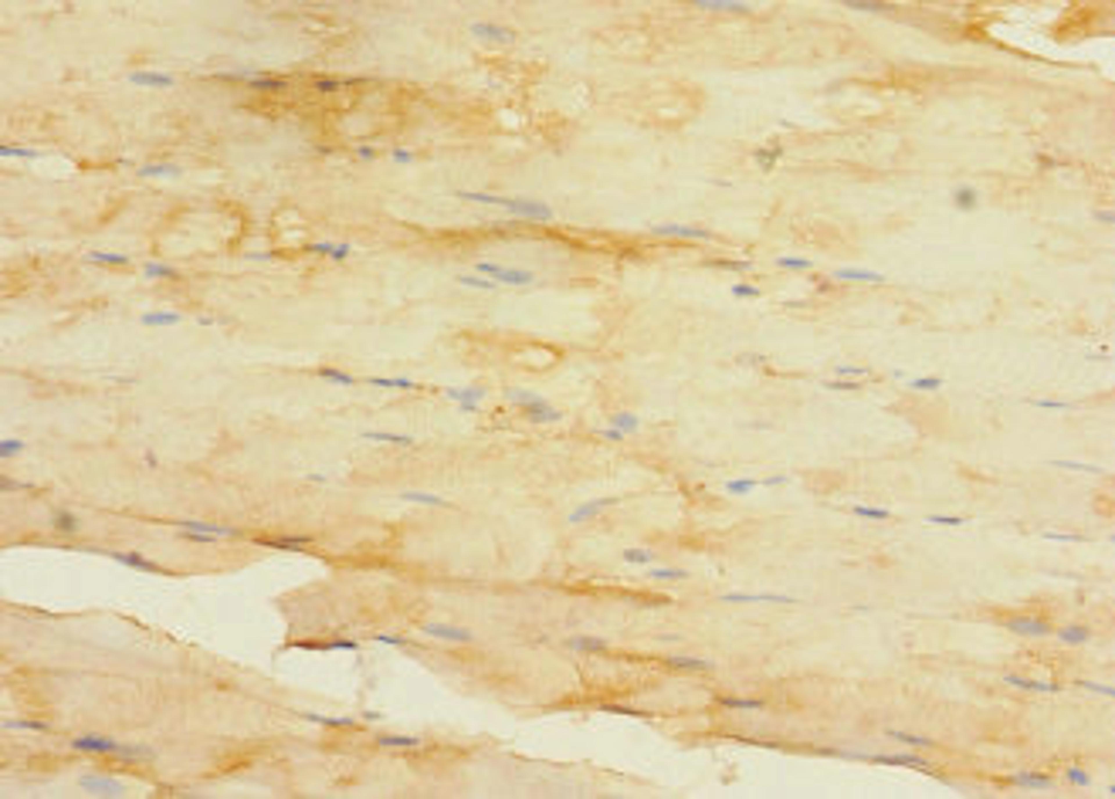 Immunohistochemistry of paraffin-embedded human skeletal muscle tissue using CSB-PA027047LA01HU at dilution of 1:100