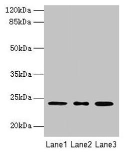 Western blot. All lanes: MRPL58 antibody at 2µg/ml. Lane 1: A549 whole cell lysate. Lane 2: Jurkat whole cell lysate. Lane 3: K562 whole cell lysate. Secondary. Goat polyclonal to rabbit IgG at 1/10000 dilution. Predicted band size: 24 kDa. Observed band size: 24 kDa
