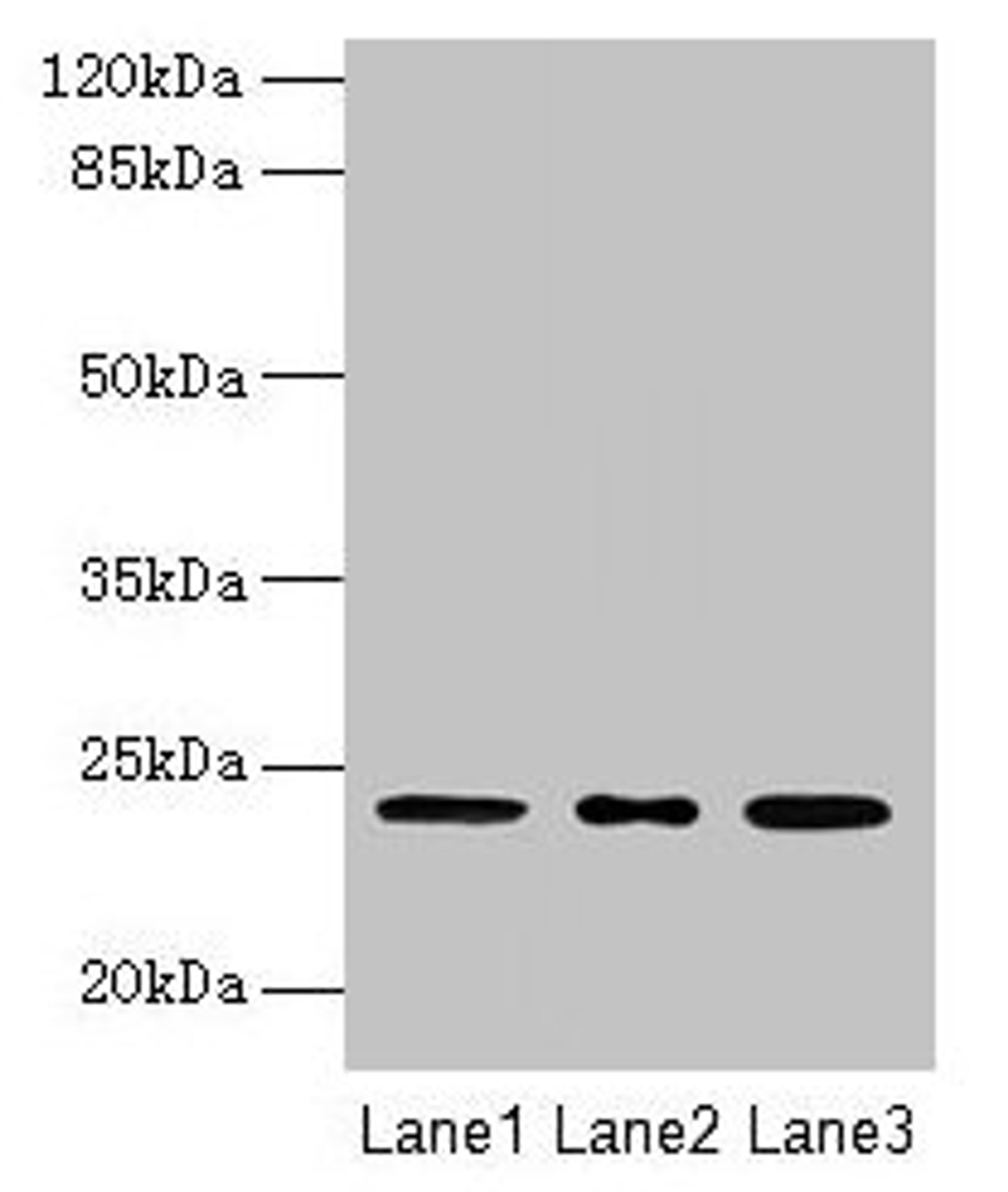 Western blot. All lanes: MRPL58 antibody at 2µg/ml. Lane 1: A549 whole cell lysate. Lane 2: Jurkat whole cell lysate. Lane 3: K562 whole cell lysate. Secondary. Goat polyclonal to rabbit IgG at 1/10000 dilution. Predicted band size: 24 kDa. Observed band size: 24 kDa