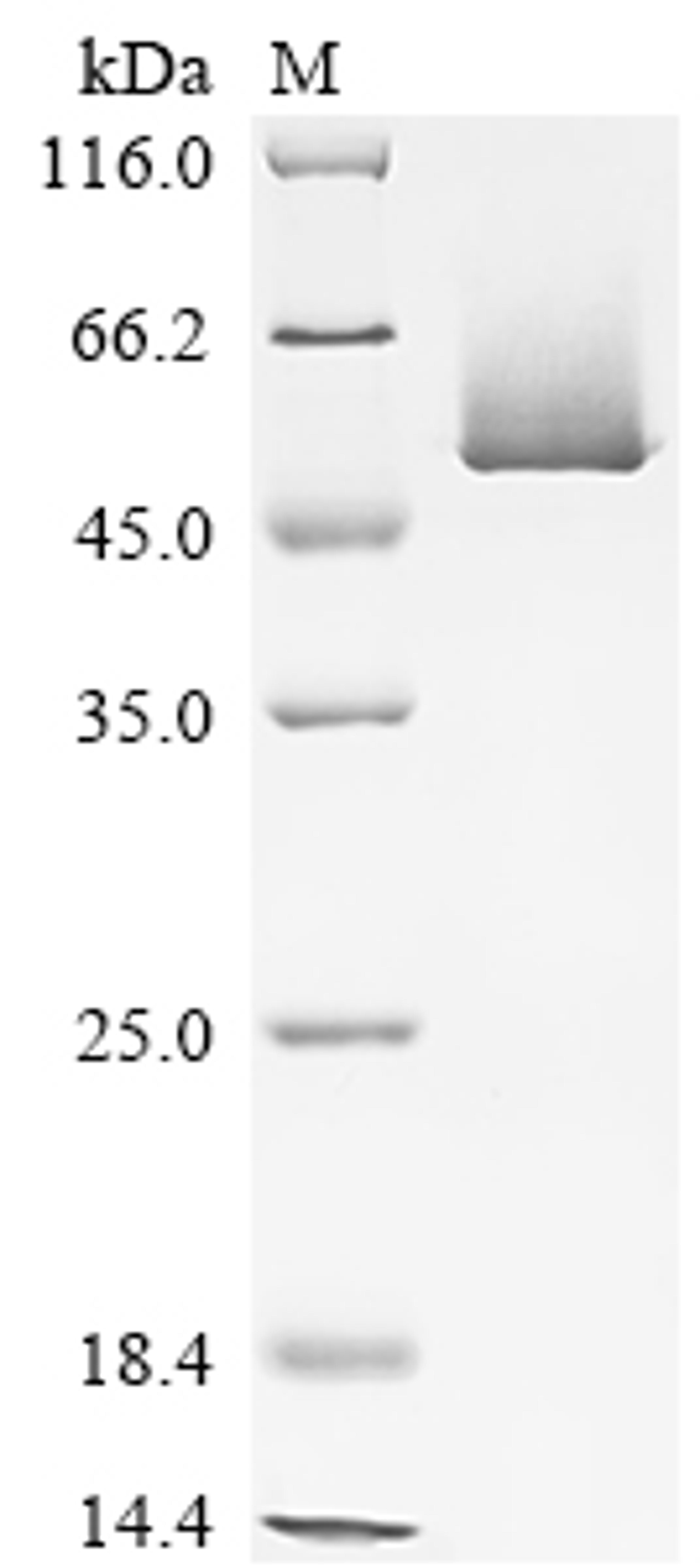 (Tris-Glycine gel) Discontinuous SDS-PAGE (reduced) with 5% enrichment gel and 15% separation gel.